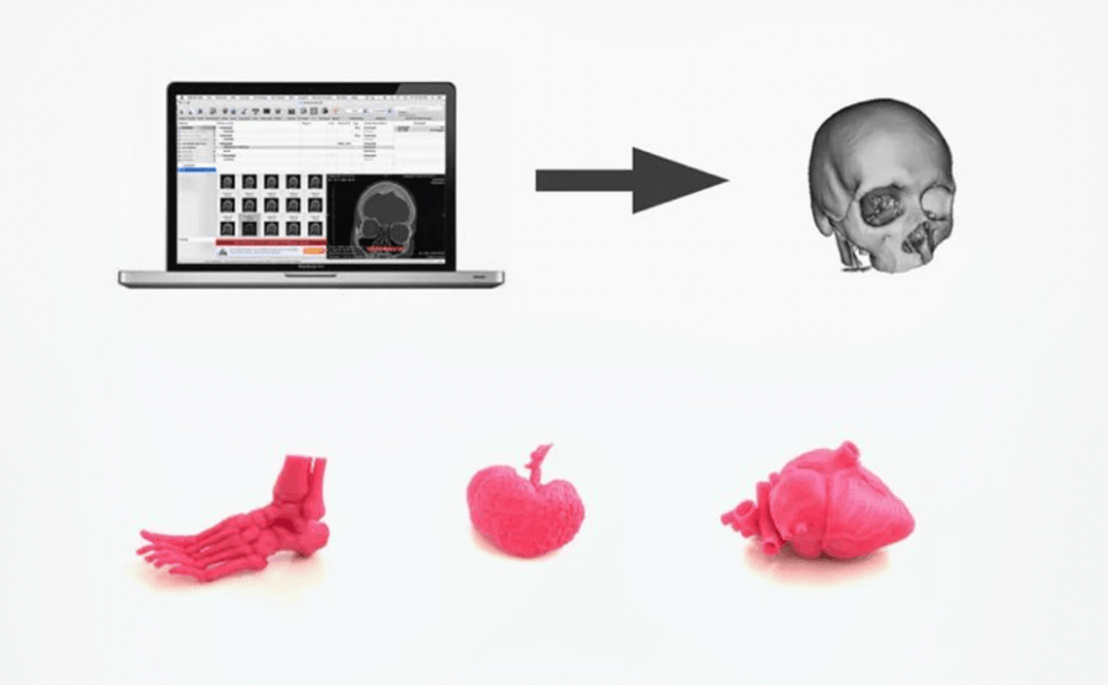 Medical imaging to 3D-printed anatomy